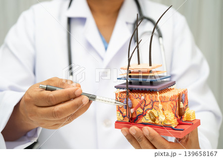 Hair transplant, Asian dermatologist doctor holding skin structure anatomy model for treatment in hospital. Hair transplant, Asian dermatologist doctor holding skin structure anatomy model for treatment in hospital. 139658167
