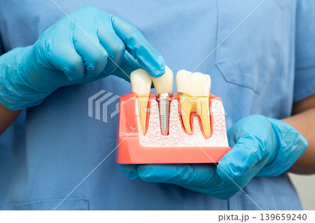 Teeth root dental model with tool for dentist use to cleaning care treatment. Teeth root dental model with tool for dentist use to cleaning care treatment. 139659240