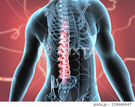 Spinal cord injury concept 139666647