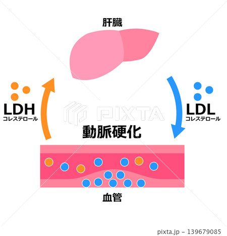 LDLとLDH 139679085