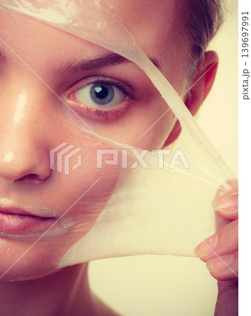 Woman removing facial peel off mask closeup 139697991