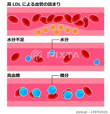 ドロドロ血の原因 139702028