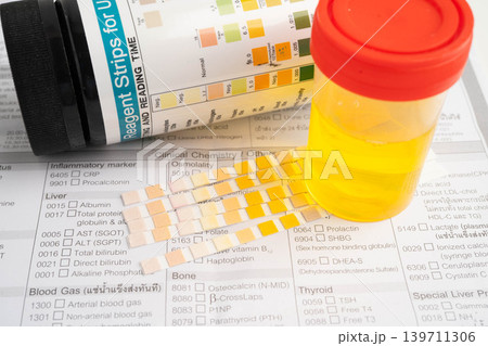 Urinalysis, urine cup with reagent strip pH paper test and comparison chart in laboratory. 139711306