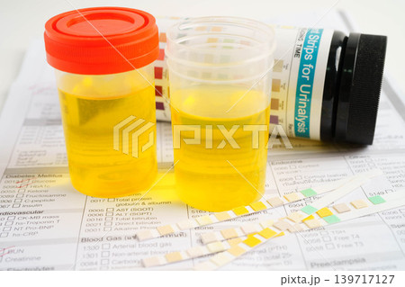 Urinalysis, urine cup for check health examination in laboratory. Urinalysis, urine cup for check health examination in laboratory. 139717127