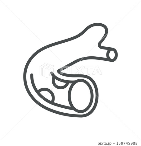 Atherosclerosis Icon. Cardiology Artery Plaque Outline Line Symbol with Narrowed Blood Vessel, Editable Stroke Vector Isolated on White Background Atherosclerosis Icon. Cardiology Artery Plaque Outline Line Symbol with Narrowed Blood Vessel, Editable Stroke Vector Isolated on White Background 139745988