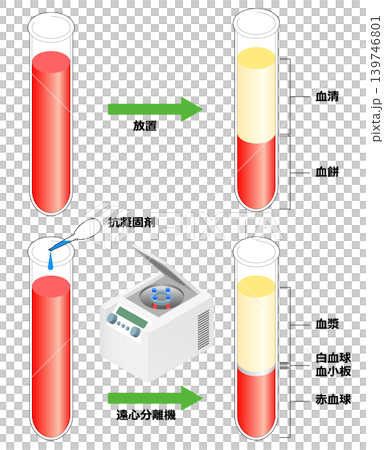 血漿和血清 血漿和血清 139746801