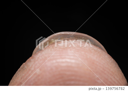 Extreme macro closeup of damaged human fingernail dry cuticle nail deterioration isolated on black background for healthcare dermatology concepts Extreme macro closeup of damaged human fingernail dry cuticle nail deterioration isolated on black background for healthcare dermatology concepts 139756782