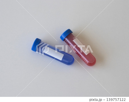 Medical test tubes with red and blue liquid for virus research and laboratory diagnostics. Healthcare composition for virus detection, infectious disease testing and scientific concepts. Hantavirus 139757122