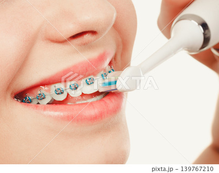Woman smiling cleaning teeth with braces Woman smiling cleaning teeth with braces 139767210