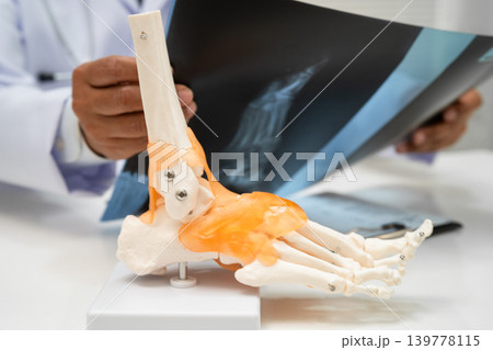 Doctor examining foot ankle joint bone radiography xray film. Doctor examining foot ankle joint bone radiography xray film. 139778115