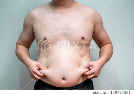 Overweight man pinches abdominal fat with both hands while standing against plain background. Shirtless body highlights excess weight and unhealthy lifestyle concerns. Overweight man pinches abdominal fat with both hands while standing against plain background. Shirtless body highlights excess weight and unhealthy lifestyle concerns. 139783561
