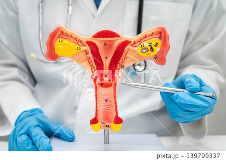 Uterus, doctor with anatomy model for study diagnosis and treatment in hospital. 139799337