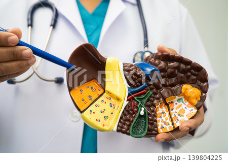 Cirrhosis, Liver cancer, fatty liver, Asian doctor with liver human model. Cirrhosis, Liver cancer, fatty liver, Asian doctor with liver human model. 139804225
