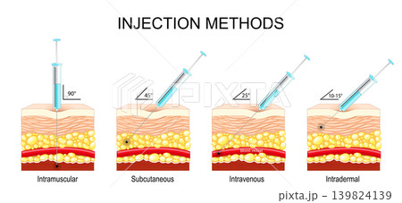 Injection methods. Intravenous, Intradermal, Subcutaneous, Intramuscular. 139824139