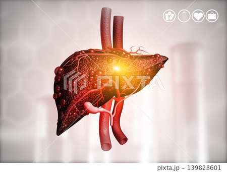 Diseased human liver on science background Diseased human liver on science background 139828601