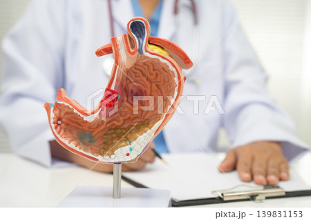 Stomach disease, doctor holding anatomy model for study diagnosis and treatment in hospital. Stomach disease, doctor holding anatomy model for study diagnosis and treatment in hospital. 139831153