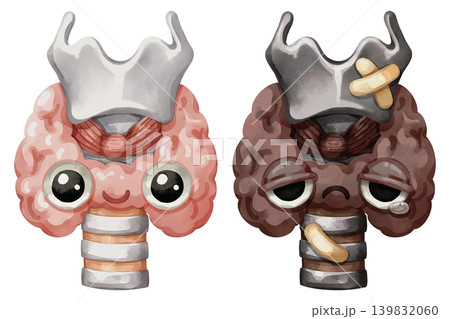 Healthy and sick thyroid gland cartoon characters with larynx. Hand drawn watercolor illustration showing a comparison of endocrine health and disease. 139832060