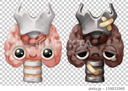 Healthy and sick thyroid gland cartoon characters with larynx. Hand drawn watercolor illustration showing a comparison of endocrine health and disease. 139832060
