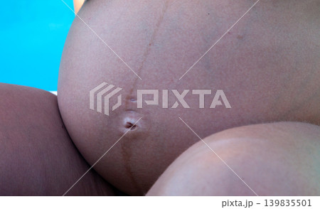 Pregnant belly detail beside swimming pool in summer Pregnant belly detail beside swimming pool in summer 139835501