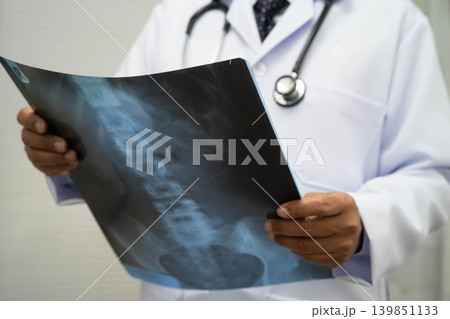 Doctor examining spine bone radiography xray film. Doctor examining spine bone radiography xray film. 139851133