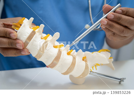 Asian doctor holding spinal nerve and bone model, Lumbar spine displaced herniated disc fragment for treatment medical in the orthopedic department. Asian doctor holding spinal nerve and bone model, Lumbar spine displaced herniated disc fragment for treatment medical in the orthopedic department. 139853226