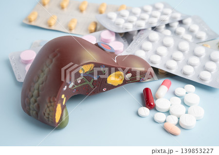 Liver model with pill drug treatment, Cirrhosis, Liver cancer, fatty liver. 139853227