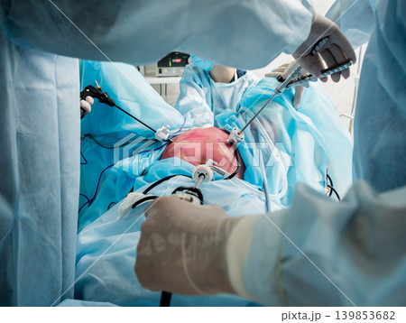 Process of gynecological surgery operation using laparoscopic equipment. Process of gynecological surgery operation using laparoscopic equipment. 139853682
