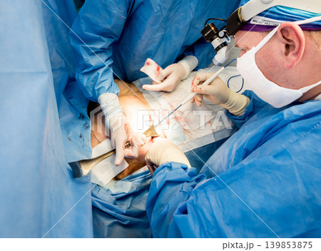 Surgery to remove the breast and replace it with an implant. Surgery to remove the breast and replace it with an implant. 139853875