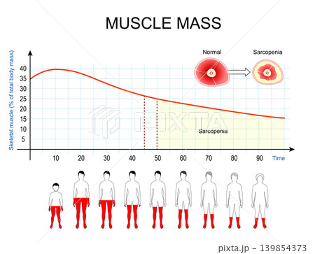 Sarcopenia and age-related muscle loss. Aging anatomy, longitudinal chart of skeletal muscle degeneration 139854373
