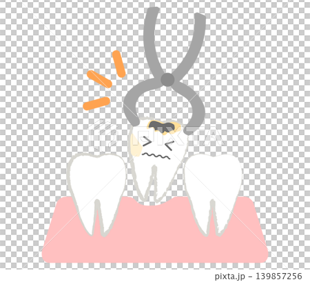 虫歯になった歯を抜歯するイラスト 139857256