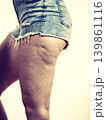 Woman legs with cellulite skin 139861116