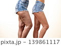 Comparison of legs with and without cellulite 139861117