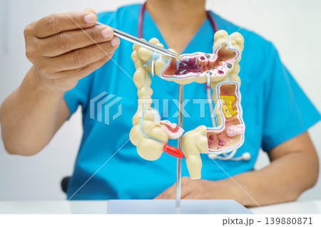 Intestine, doctor holding human anatomy model for study diagnosis and treatment in hospital. Intestine, doctor holding human anatomy model for study diagnosis and treatment in hospital. 139880871