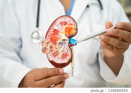 Chronic kidney disease, Asian woman with model for treatment urinary system, urology, Estimated glomerular filtration rate eGFR. 139880930