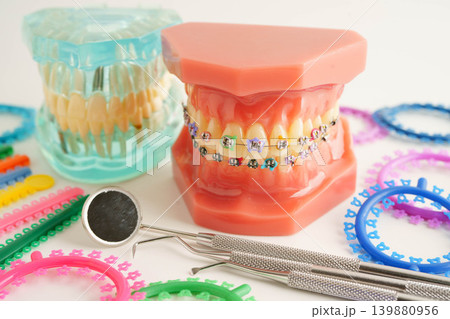 Orthodontic ligatures rings and ties, elastic rubber bands on orthodontic braces, model for dentist studying about dentistry. 139880956