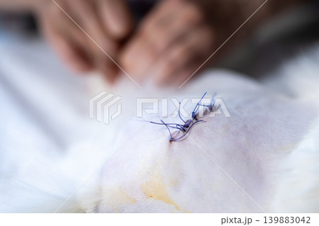 Focused clinical scene showing delicate suturing with sterile equipment and careful hand movements 139883042
