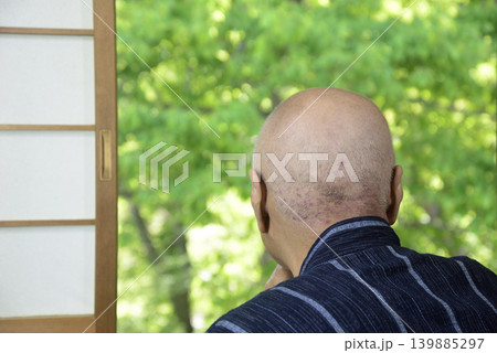 老人後頭部の皮膚病 老人後頭部の皮膚病 139885297
