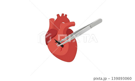 Silver Tweezers Pulling a Black Thorn from a Red Heart Silver Tweezers Pulling a Black Thorn from a Red Heart 139893060