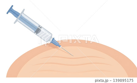 Botox Syringe over Fading Forehead Wrinkles Botox Syringe over Fading Forehead Wrinkles 139895175