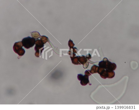 カビの胞子から発芽している様子 カビの胞子から発芽している様子 139916831
