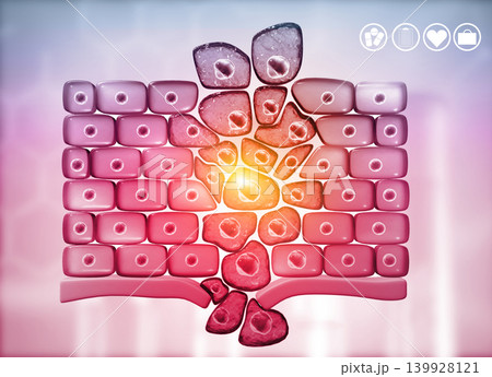 Cancer cells growing, medical background 139928121