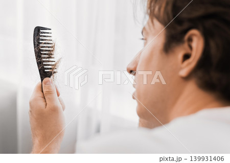 A stressed man looks at a comb full of fallen hair during grooming. This concept of male hair loss, thinning, and alopecia can be related to testosterone issues. A stressed man looks at a comb full of fallen hair during grooming. This concept of male hair loss, thinning, and alopecia can be related to testosterone issues. 139931406