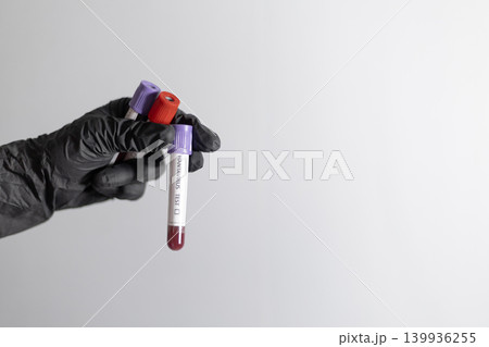 Hand Holding Hantavirus Test Blood Sample Tube Hand Holding Hantavirus Test Blood Sample Tube 139936255