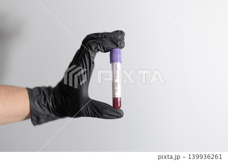 Hand Holding Hantavirus Test Blood Sample Tube Hand Holding Hantavirus Test Blood Sample Tube 139936261