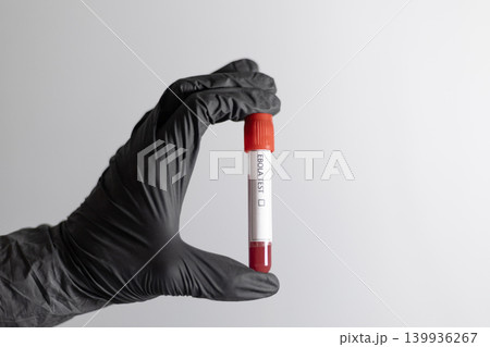Hand Holding Ebola Test Blood Sample Tube Hand Holding Ebola Test Blood Sample Tube 139936267
