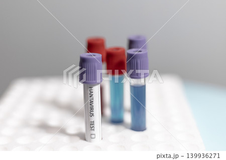 Hantavirus and Medical Test Tubes in Rack 139936271