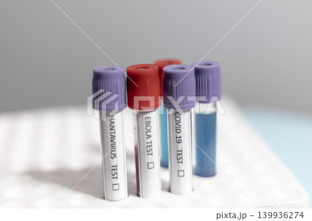 Medical Test Tubes Labeled for Hantavirus Ebola and Covid 19 139936274