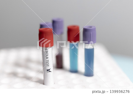 Ebola and Medical Test Tubes in Rack Ebola and Medical Test Tubes in Rack 139936276