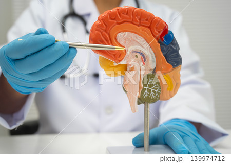 Alzheimer disease, Asian doctor holding brain anatomy model for study diagnosis and treatment in hospital. Alzheimer disease, Asian doctor holding brain anatomy model for study diagnosis and treatment in hospital. 139974712
