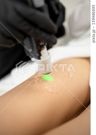 Cosmetologist performing laser hair removal procedure on young woman in beauty clinic. Aesthetic medicine, skincare, body care and professional cosmetic treatment concept. Cosmetologist performing laser hair removal procedure on young woman in beauty clinic. Aesthetic medicine, skincare, body care and professional cosmetic treatment concept. 139986895